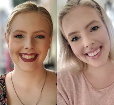 Image by Invisalign®